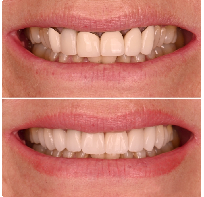 Smile transformation results