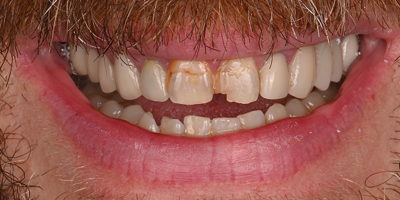 Before dental treatment