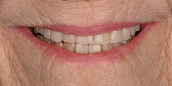 Before dental treatment