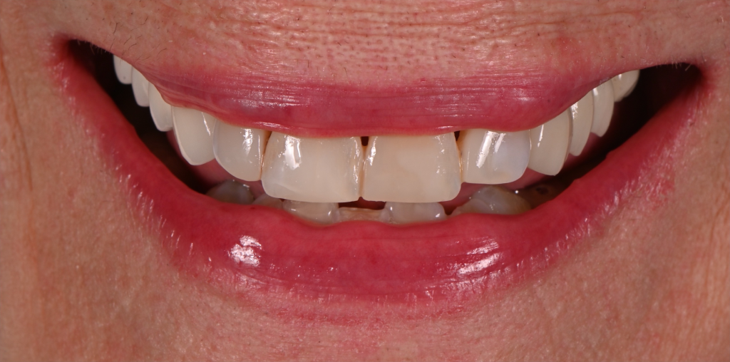 Comprehensive Cosmetic After