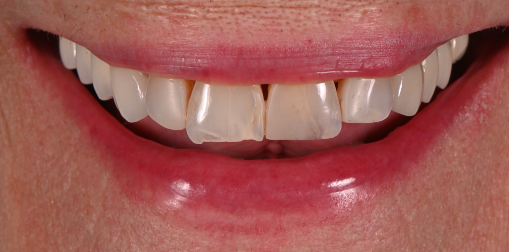 Comprehensive Cosmetic Before